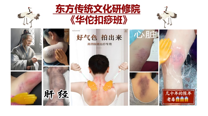 华佗扣痧课程